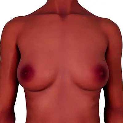 Skin type